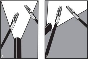 coaxial view