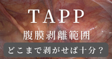 TAPP 腹膜剥離　範囲
